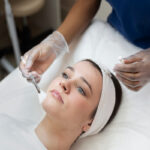 person getting micro needling beauty treatment 1290x750 1