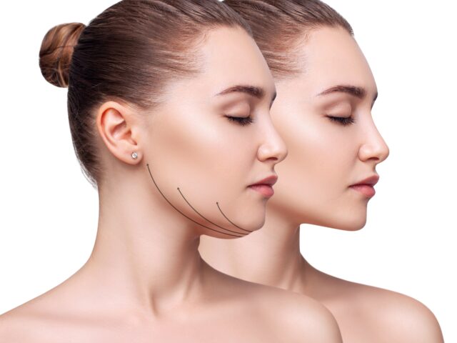 What to Expect During Your First Session of Quantum RF Treatment in Bedford TX