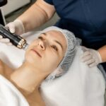 Provider applying a Quantum RF vs Morpheus8 radiofrequency handpiece to a patient's cheek during a non-surgical facial skin tightening treatment session