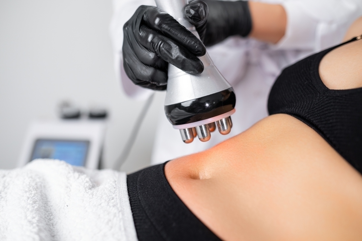 Quantum RF Treatment in Southlake, provider applying RF handpiece to abdomen