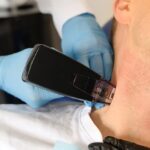 Provider applying a Morpheus8 RF microneedling handpiece to a male patient’s jawline and neck area, illustrating how long do Morpheus8 results last with consistent treatment sessions.
