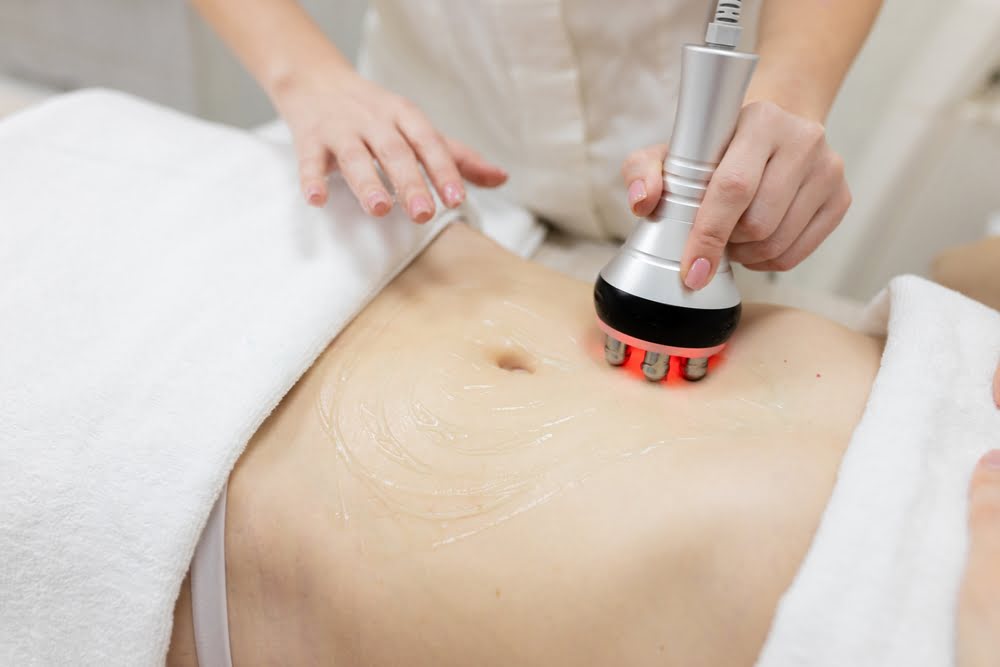 Quantum RF Treatment in Lewisville TX abdomen contouring session at Medi-Elite Health & Wellness