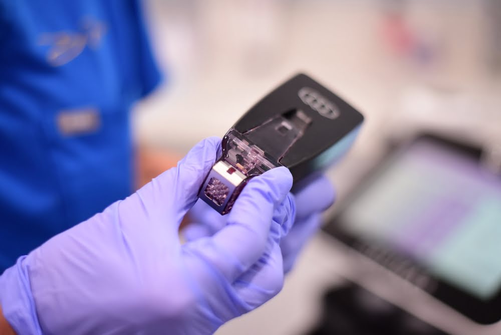 Can Morpheus8 Be Used on the Body? A Zone-by-Zone Guide