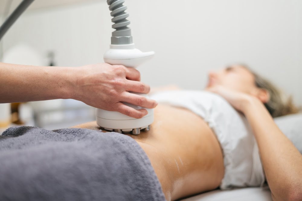 What Is Quantum RF Smart Lipo and How Is It Different From Regular Liposuction?